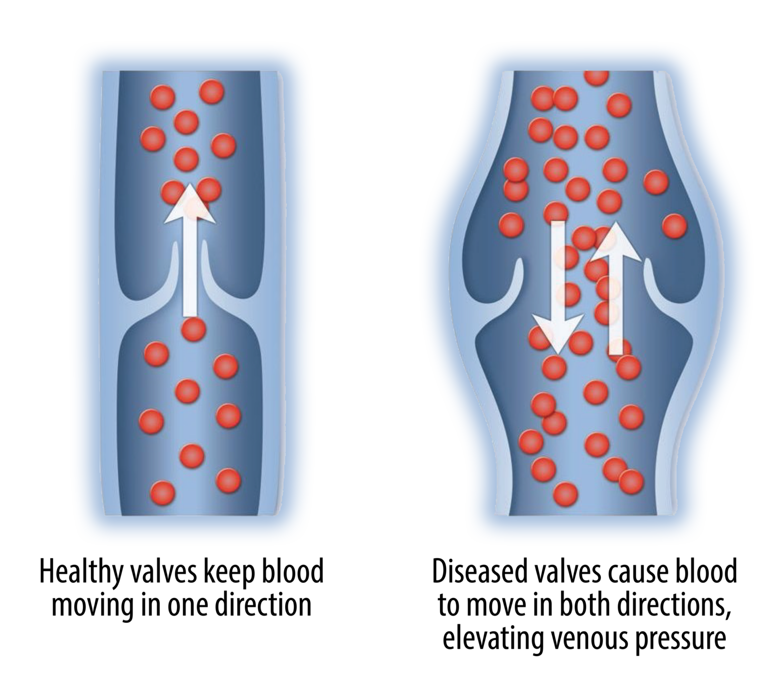 Vessel Ablation and Vein Ablation Wellness and Pain
