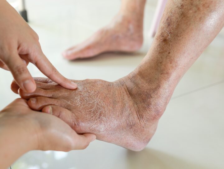 An elderly woman receiving diabetic leg pain treatment in a doctor's office.