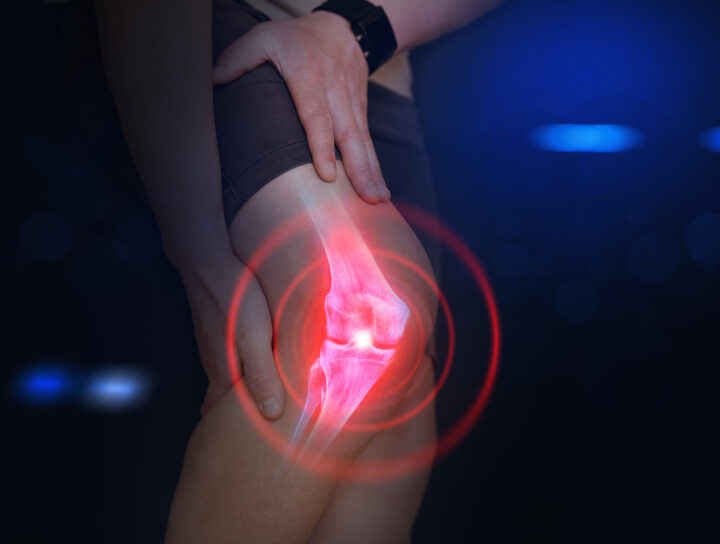An x-ray visualization of someone who needs knee injections for pain, as they're holding their knee in pain.