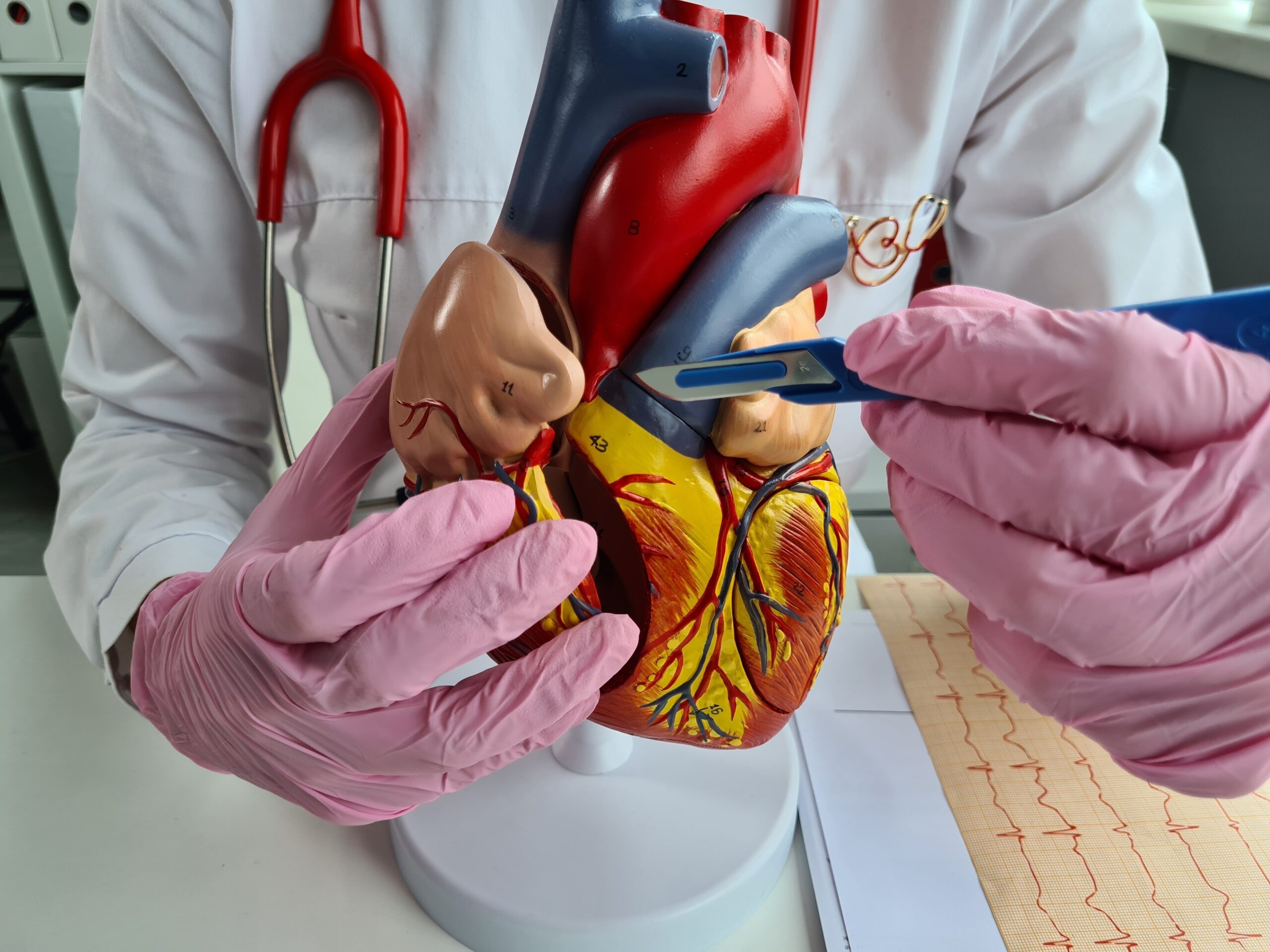 A close-up of a cardiac risk assessment in New Jersey doctor pointing out something on a model of a heart.