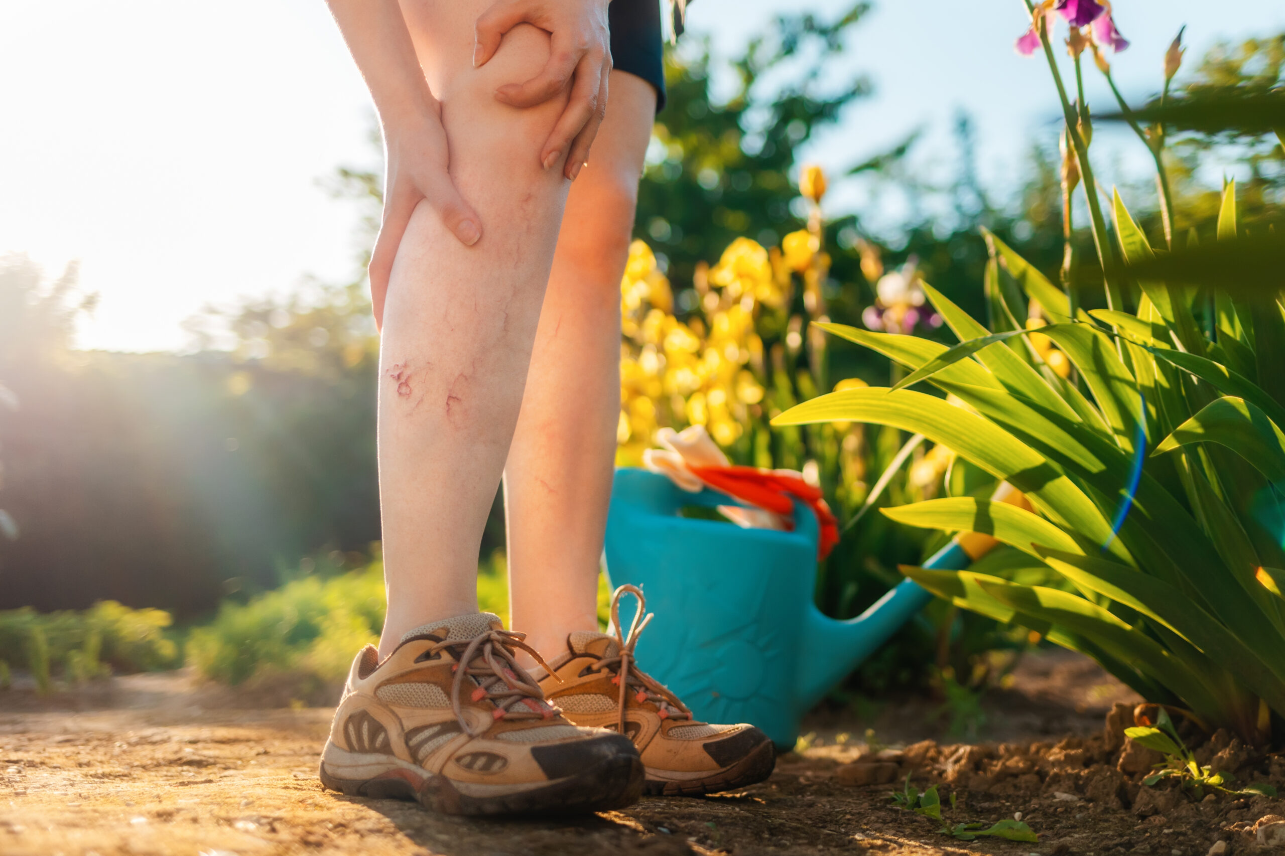 A woman holds her varicose vein leg while walking outside and considering leg fatigue treatment.