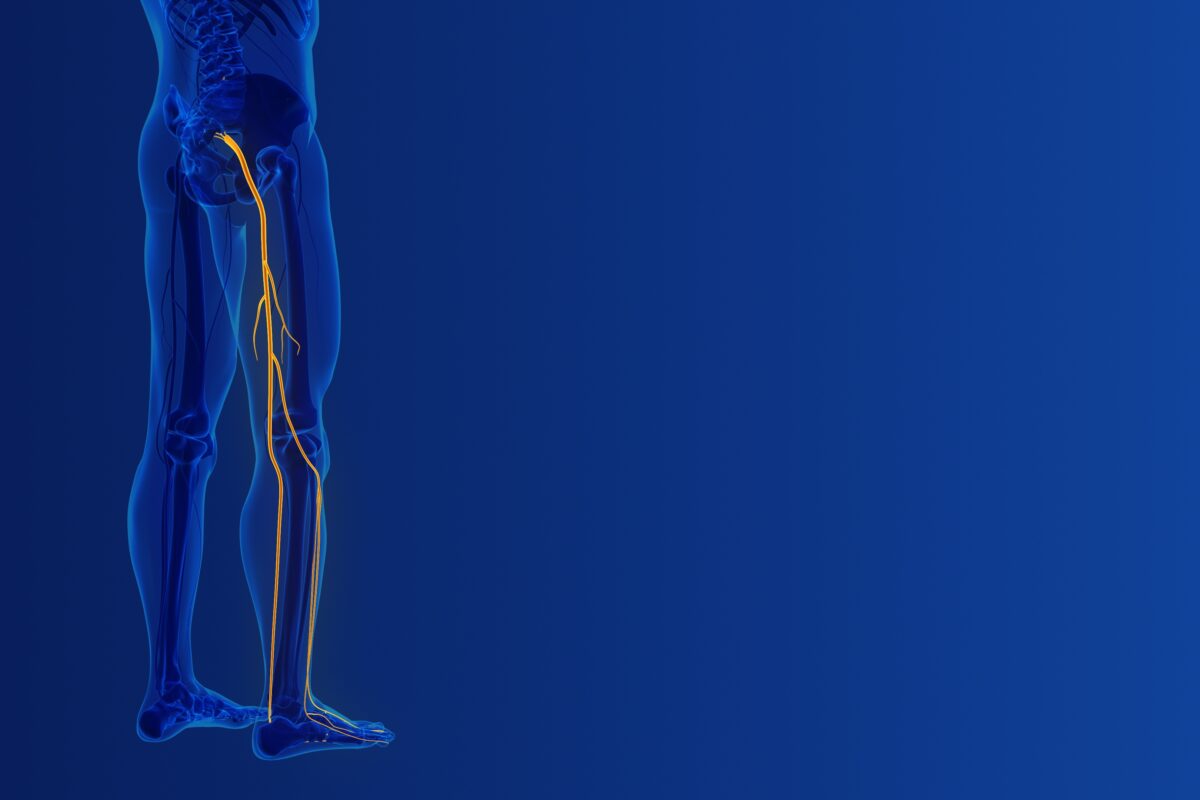 An neural illustration of the Sciatic Nerve in the buttocks and leg, which relief of sciatica pain points to.