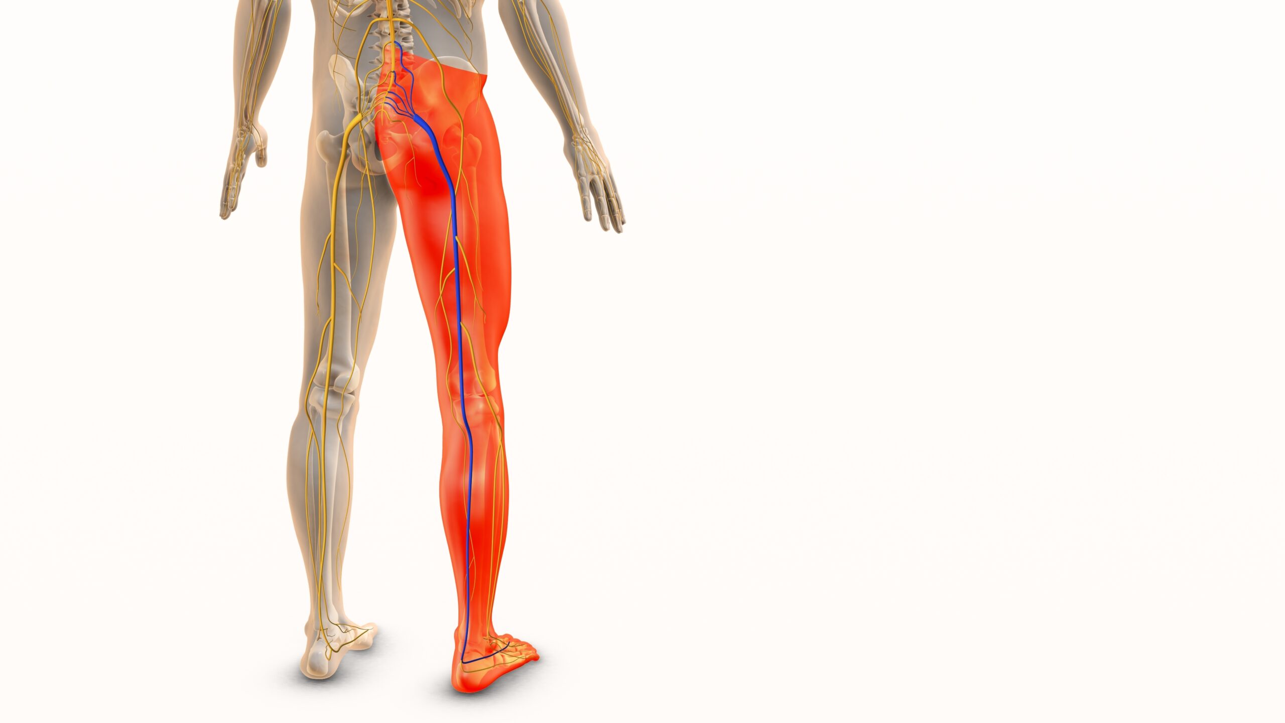 Sciatica and lower leg pain, as illustrated by the inflamed nerves running down the back of an adult male leg in this medical diagram, should cause patients to understand what's behind it.