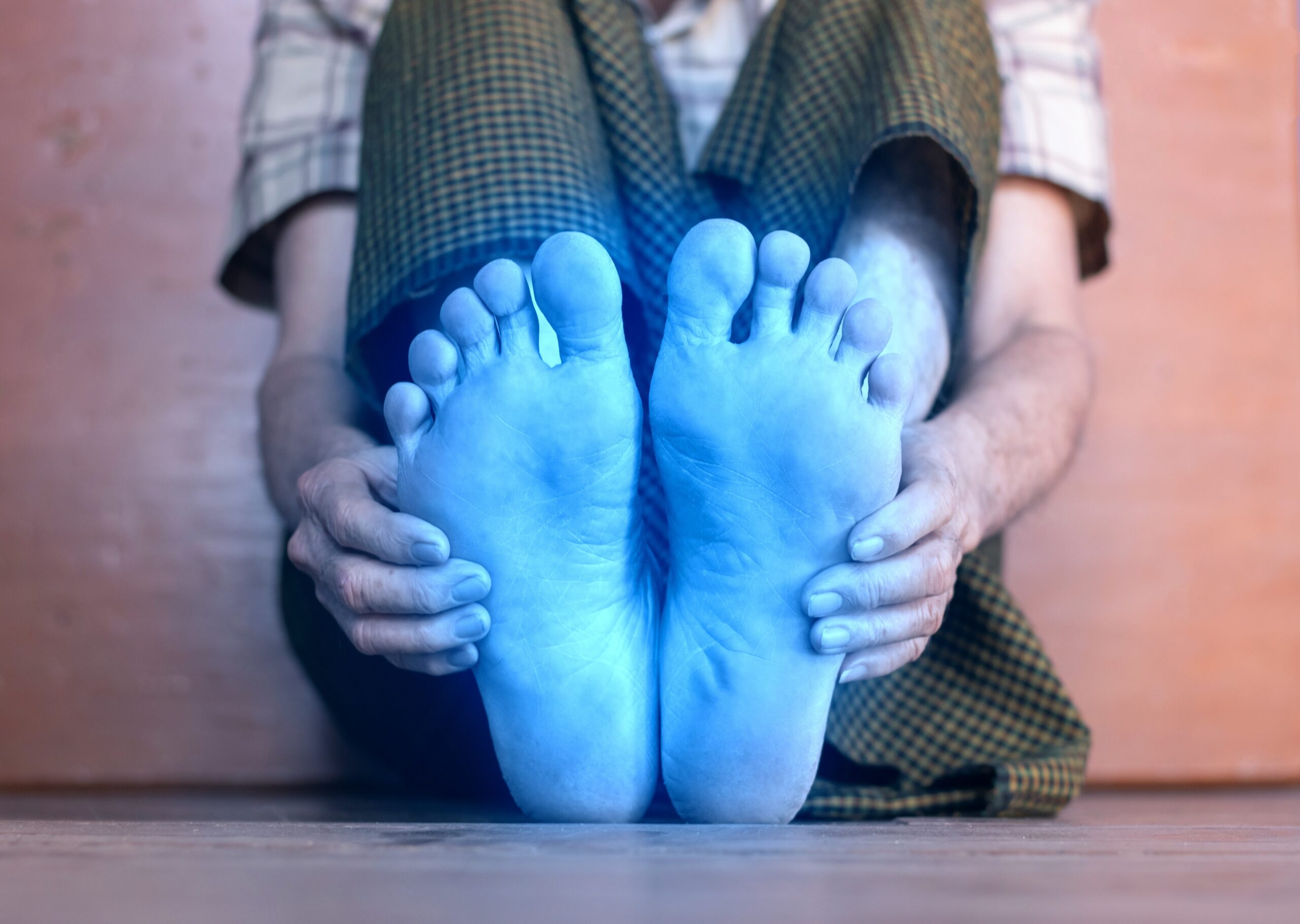 An image of itchy, blue feet that feel on fire for a patient who has poor circulation to feet problems.
