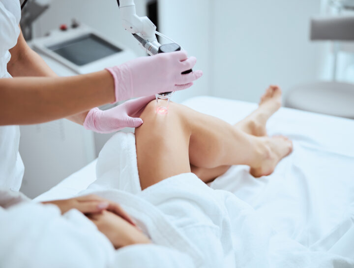 A woman receives spider vein cosmetic treatment from a pain management specialist doctor.
