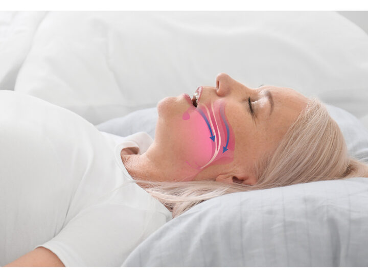 An illustration of air-breathing in a woman sleeping on her pillow, pointing to today's HST test options.
