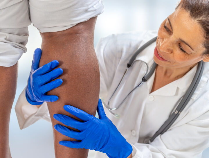 A doctor providing varicose veins treatment to an older lady who is a patient as her leg is inspected.