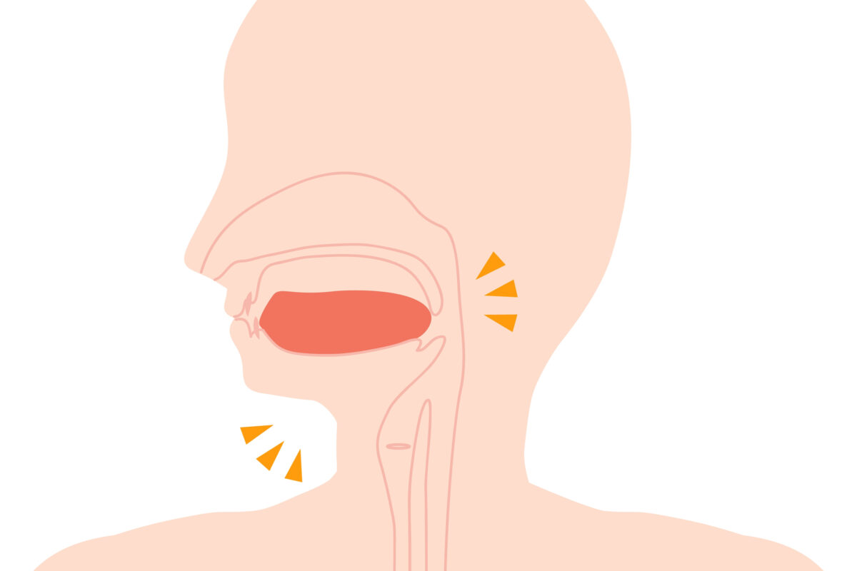 Oral appliances are a great sleep apnea test kit option, as illustrated by this mouth-and-tongue graphic of a human being.