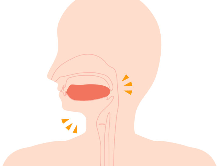 Oral appliances are a great sleep apnea test kit option, as illustrated by this mouth-and-tongue graphic of a human being.