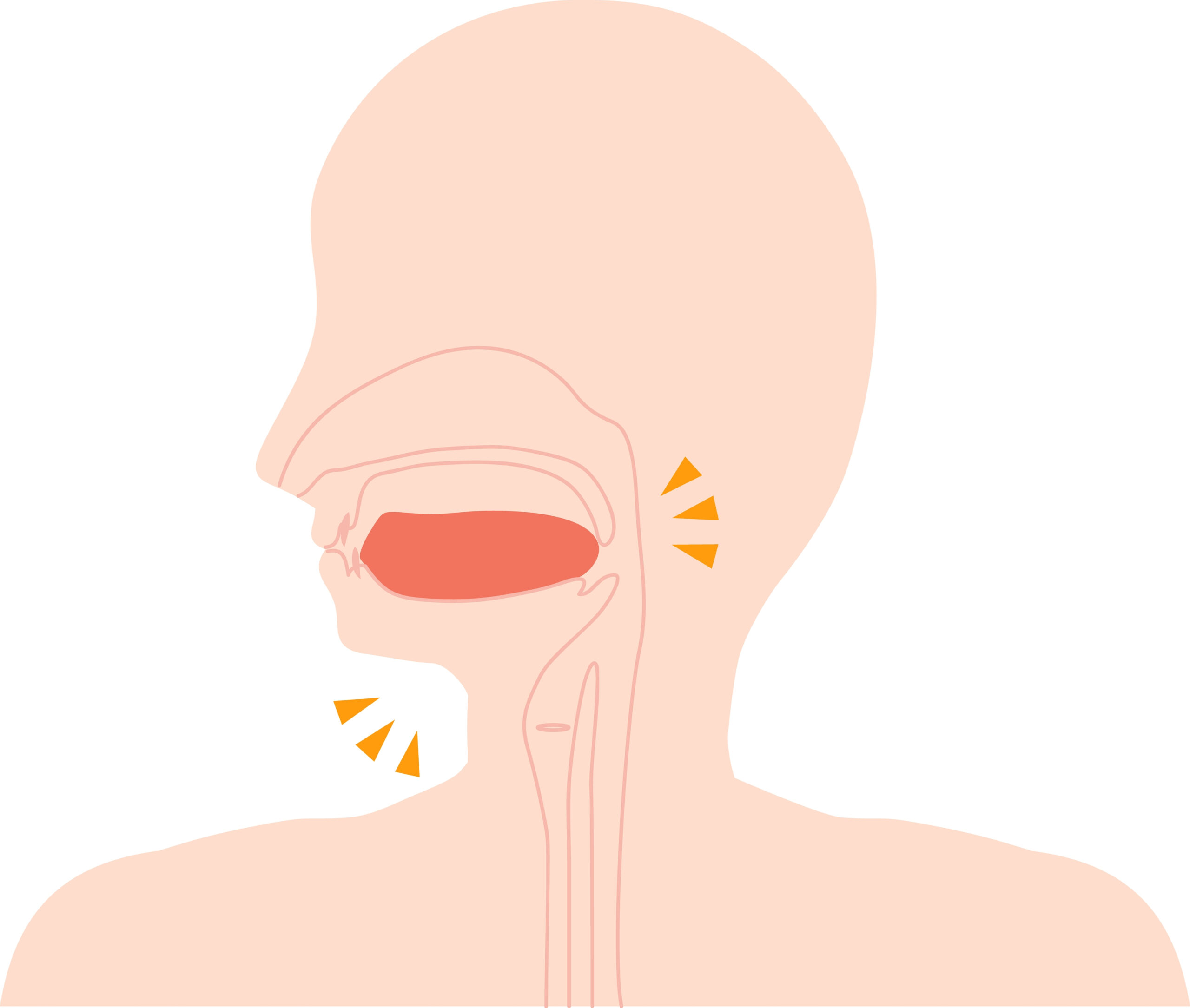 Oral appliances are a great sleep apnea test kit option, as illustrated by this mouth-and-tongue graphic of a human being.