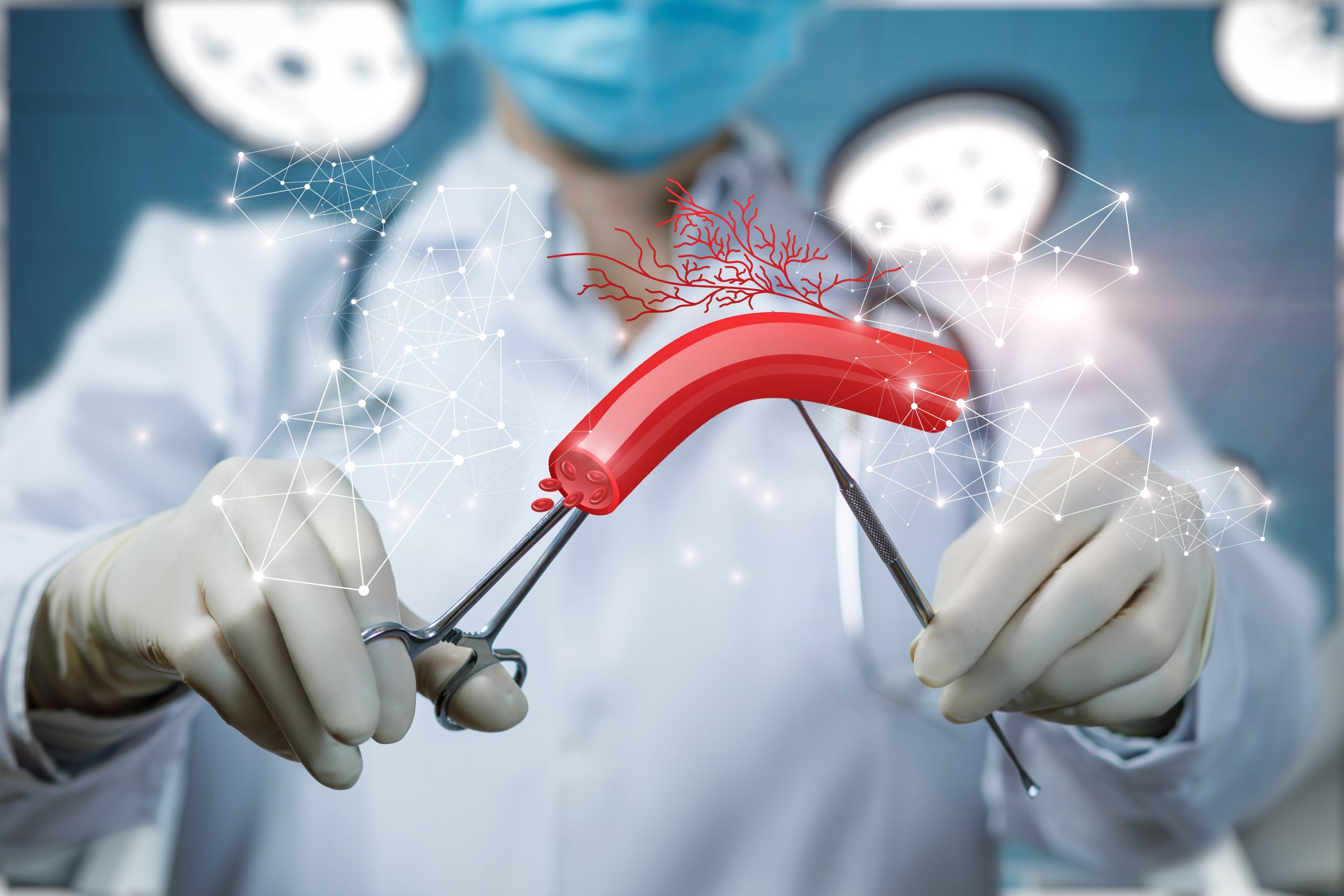 A doctor-with-utensils illustrative visual of treating blood vessels through blood circulation surgery.